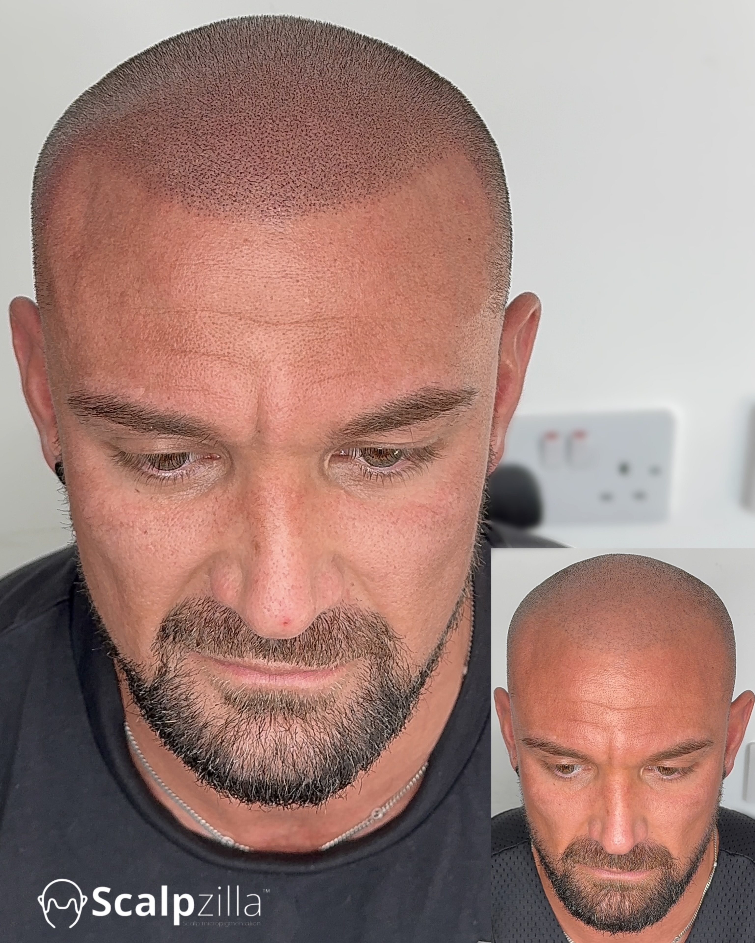 Before and After 5