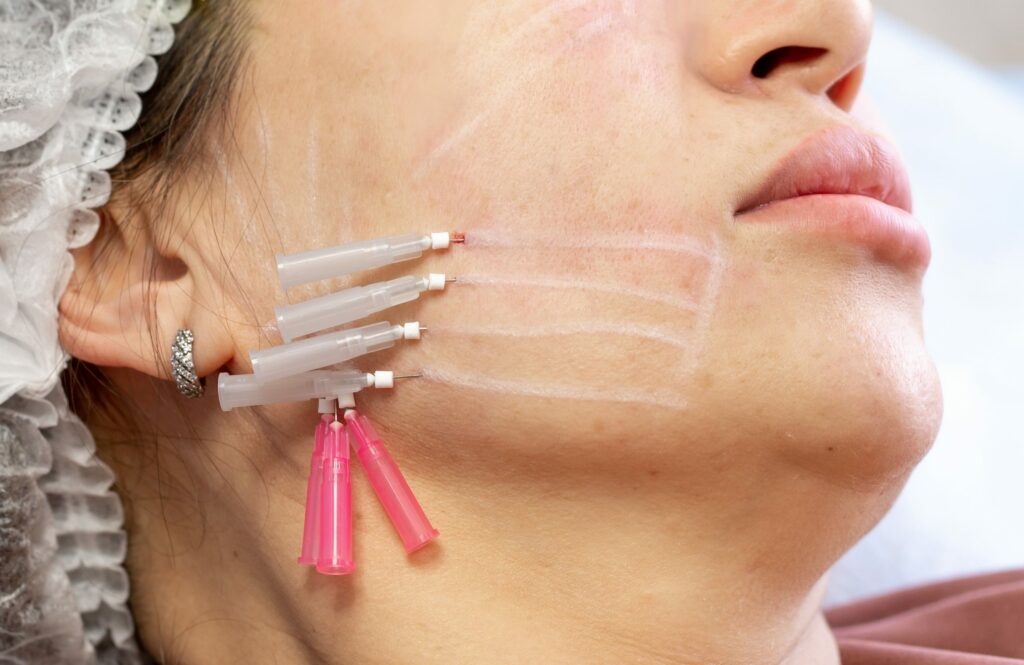 Stimulates Collagen