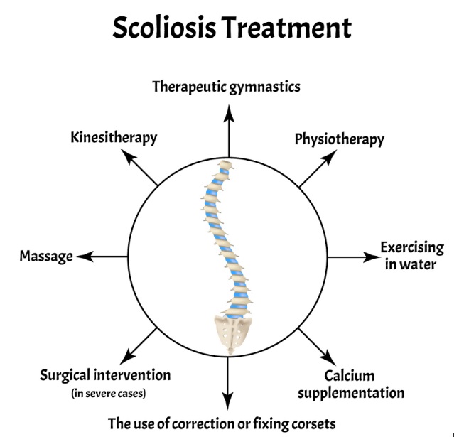 Scoliosis treatment options diagram with spine Scoliosis treatment options diagram with spine