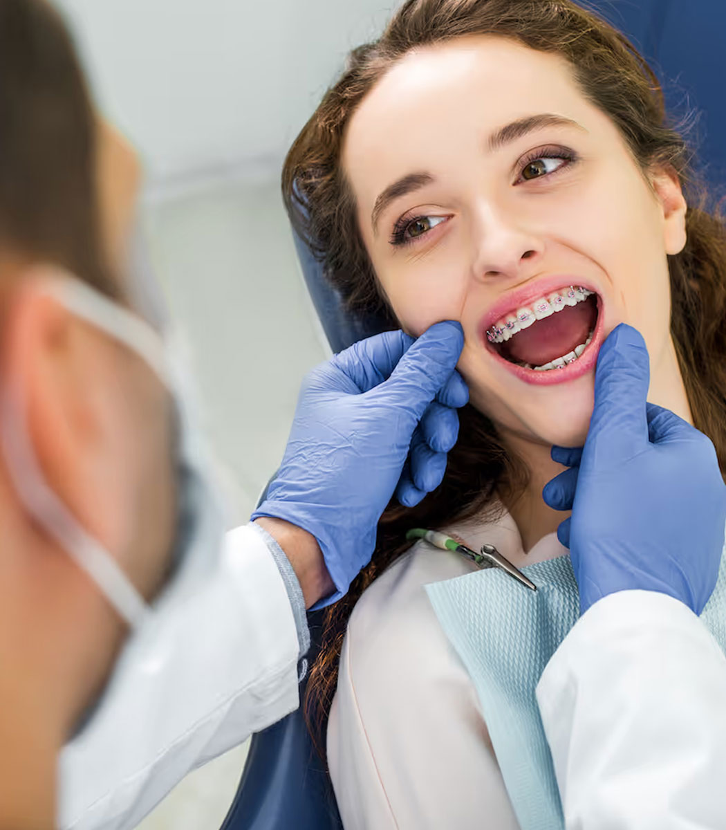 Traditional Braces