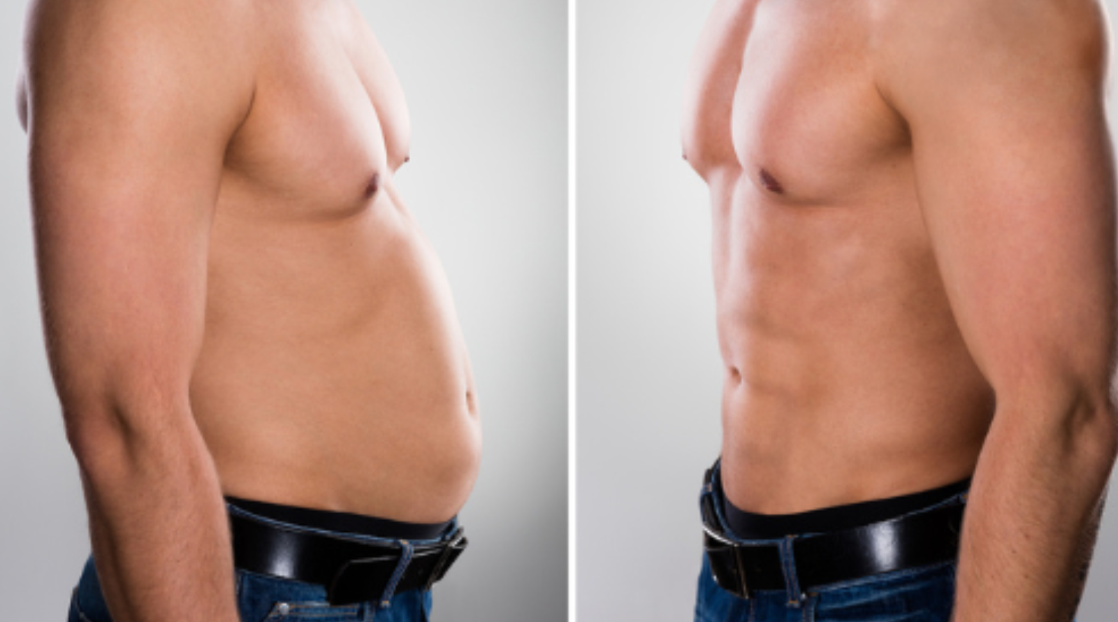 before and after emsculpt neo results