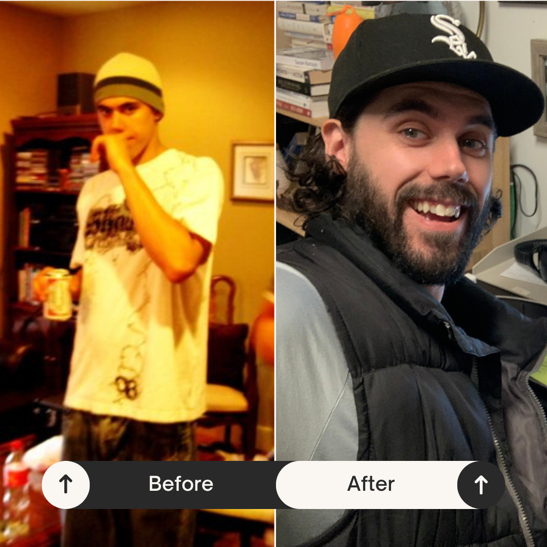before and after photo before and after photo