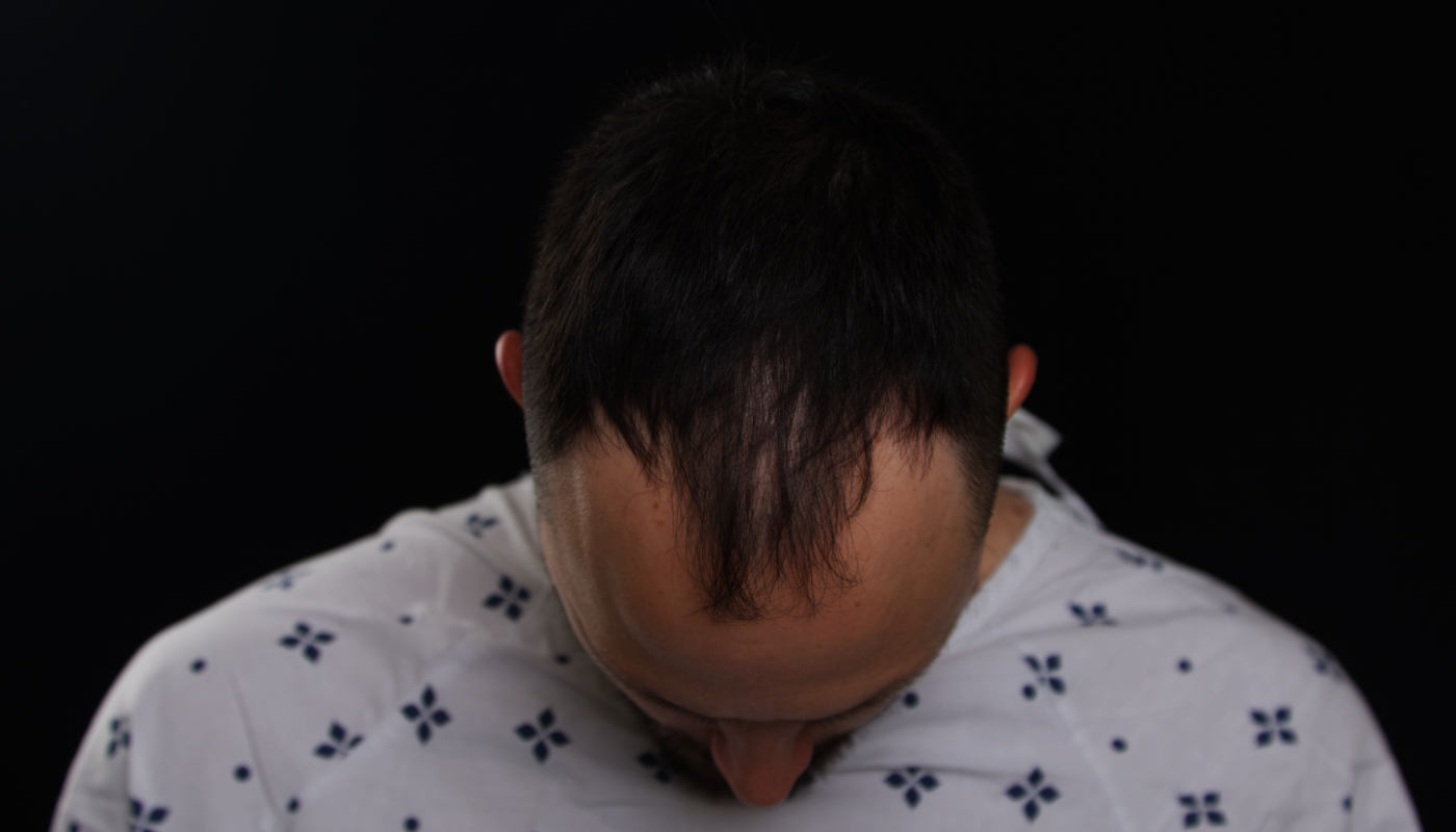 After