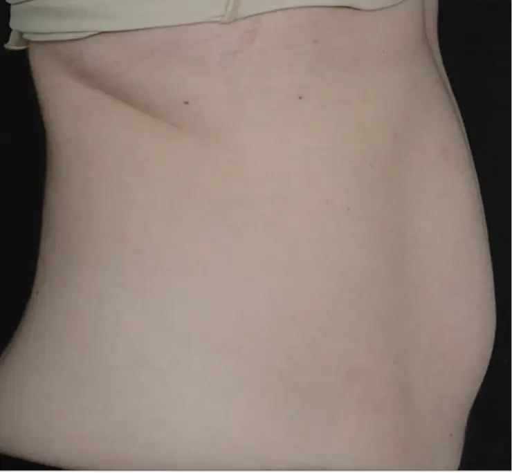 Before transformation