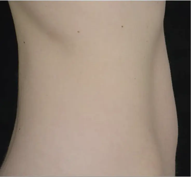After transformation