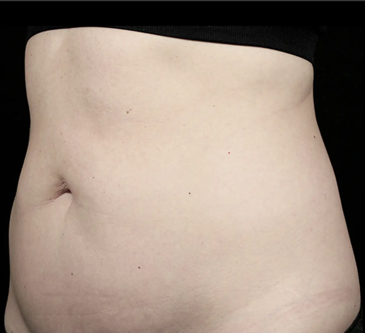Before transformation