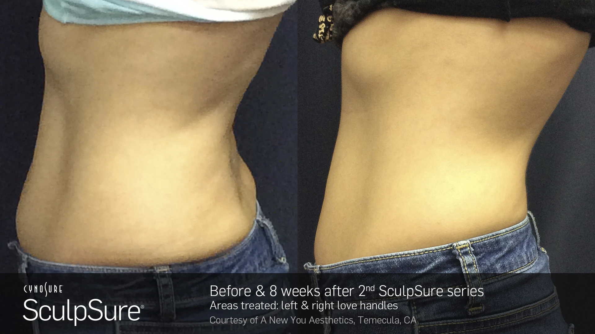 Before and After