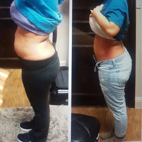 Before and After
