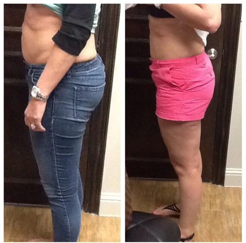 Before and After