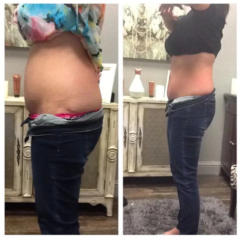 Before and After