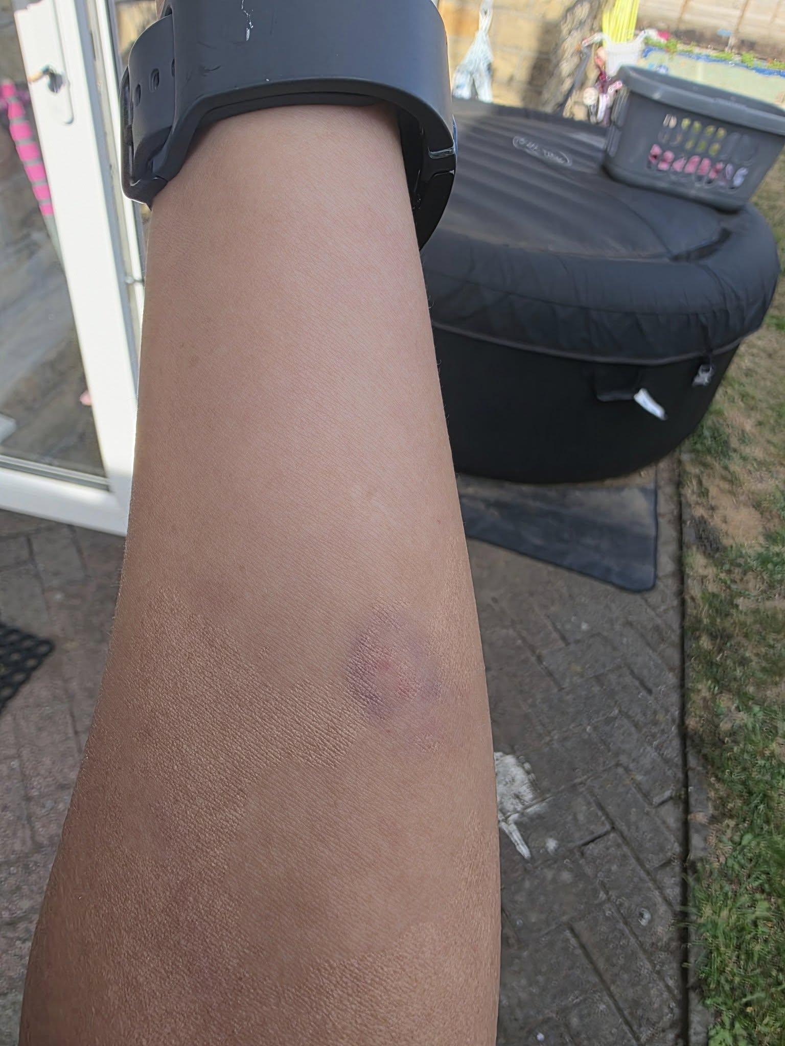 apple bruise apple bruise