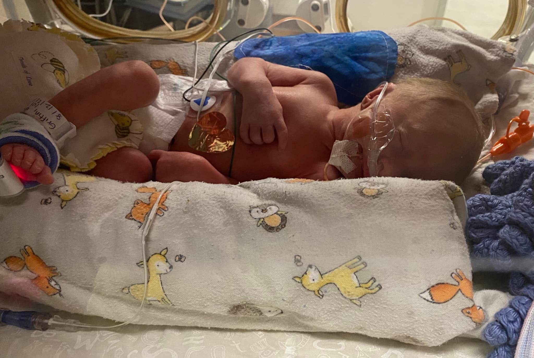 Birth