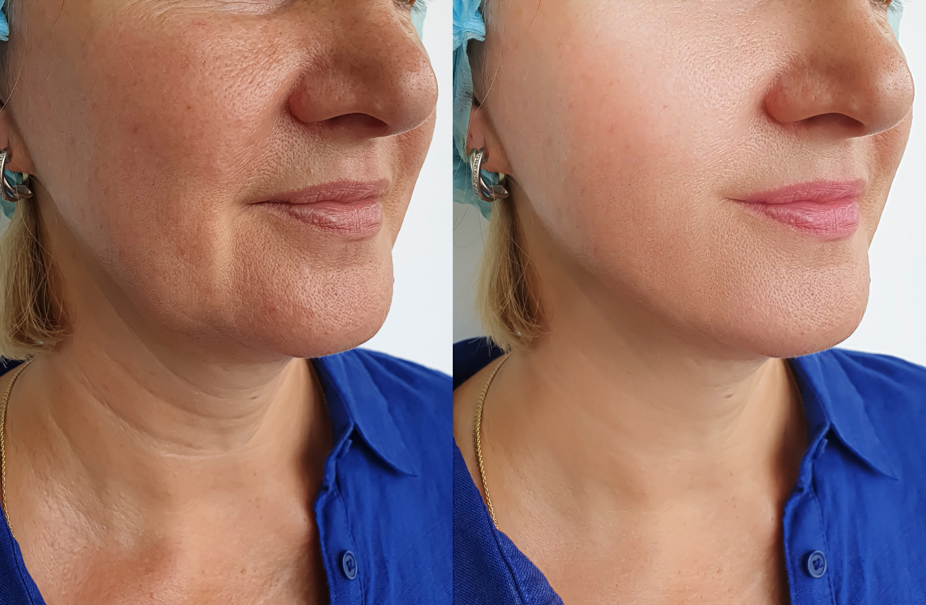 Beauty Secret Dr-Pro | Skin & Hair Rejuvenation at Home Beauty Secret Dr-Pro | Skin & Hair Rejuvenation at Home