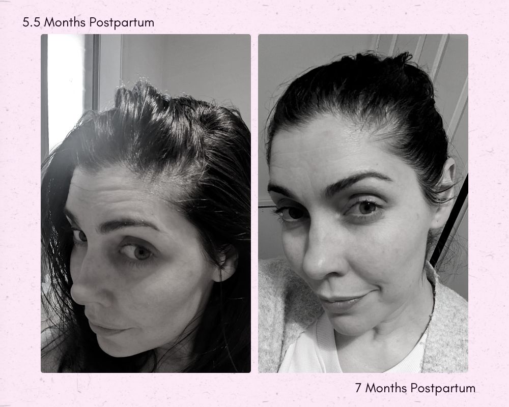 Before and After Before and After