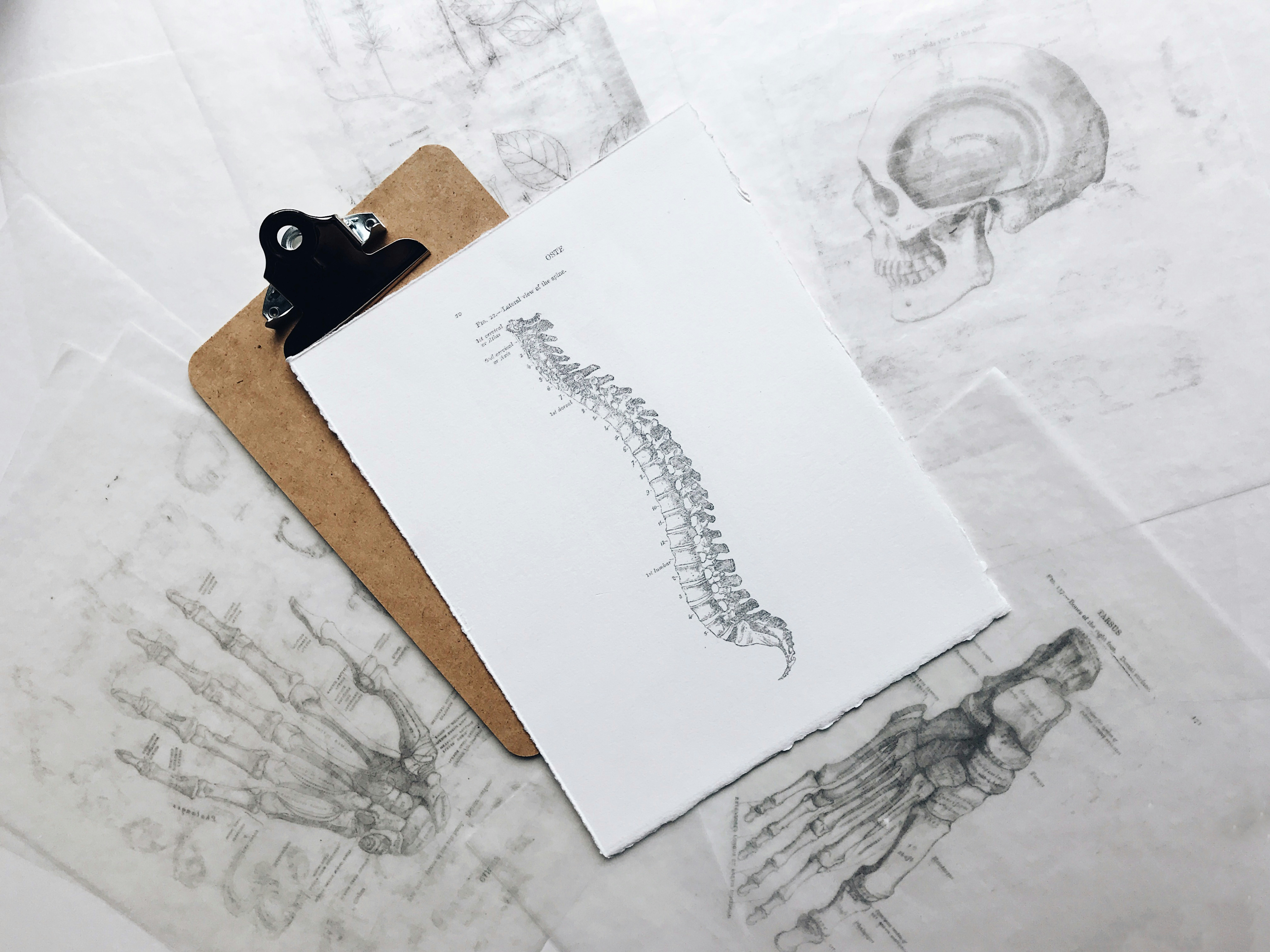low back pain