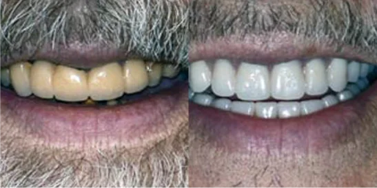 Patient Before After Image