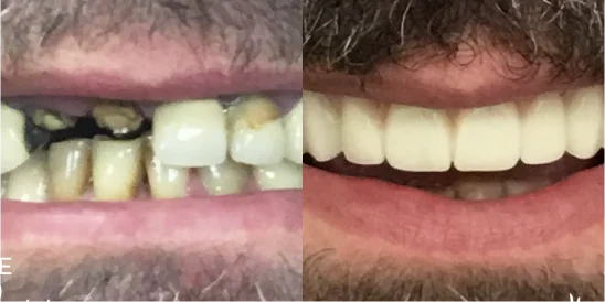 Patient Before After Image