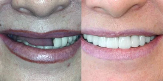 Patient Before After Image