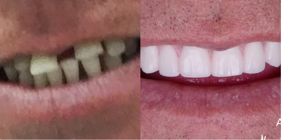 Patient Before After Image