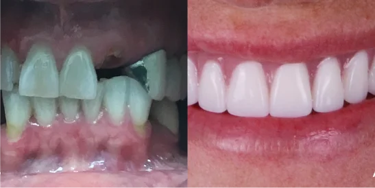 Patient Before After Image
