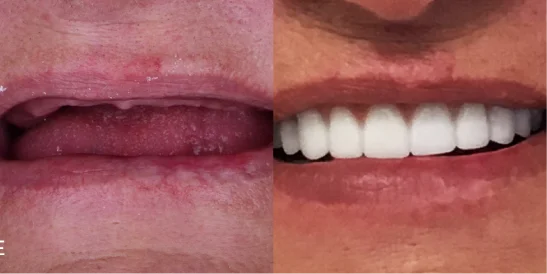 Patient Before After Image