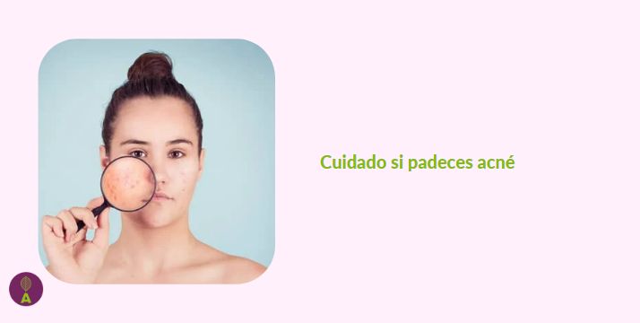 Cuidado con el ejercicio si padeces acné