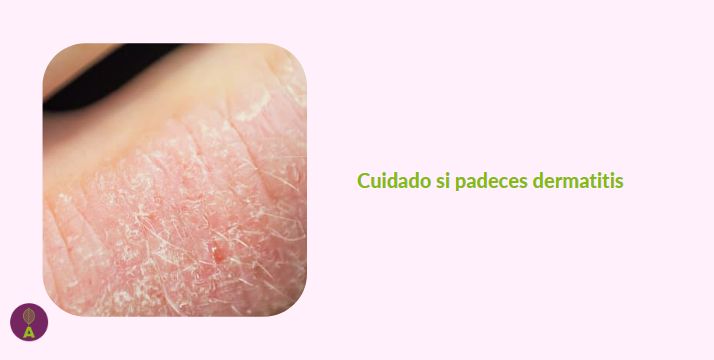 La dermatitis y las aguas cloradas no son buena pareja