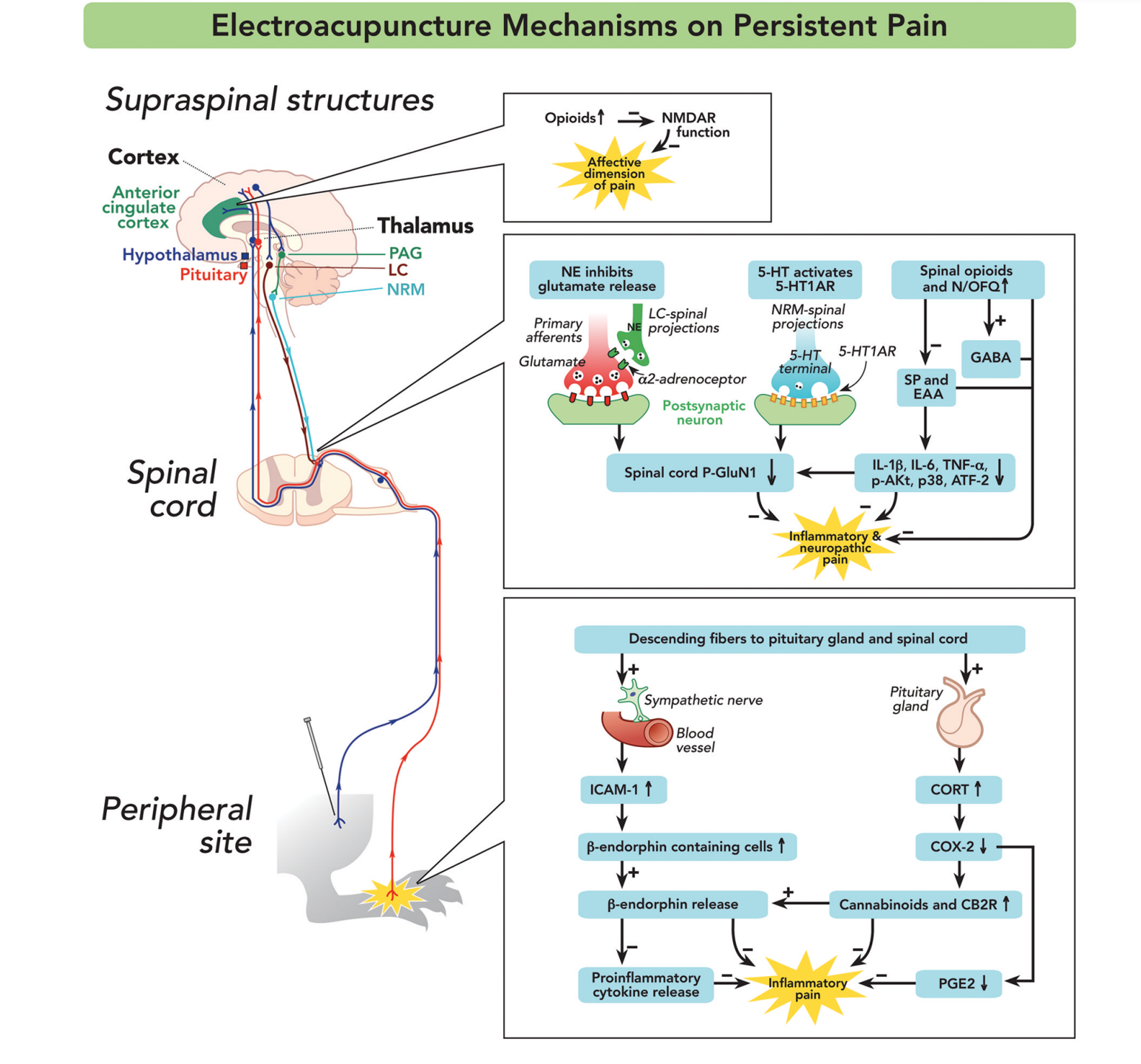 acupuncture for pain