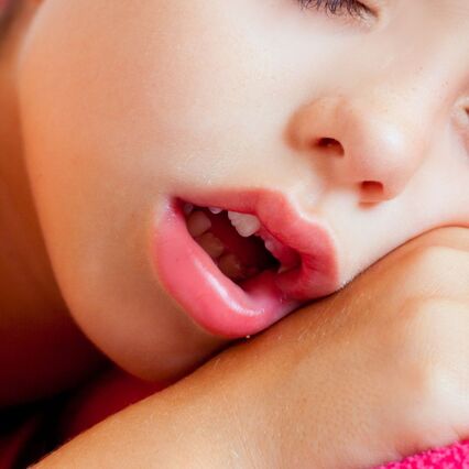 Mouth Breathing/Open-Mouth Posture 