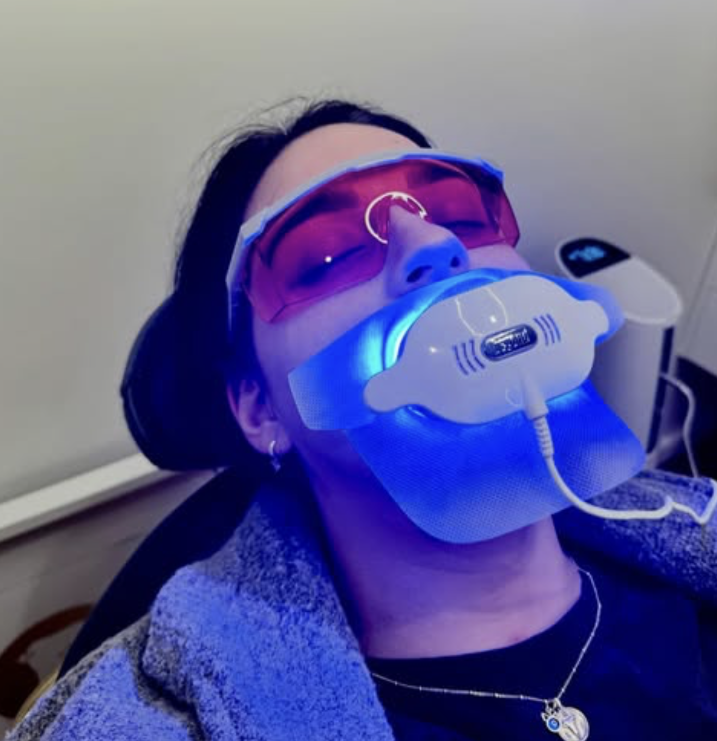 Professional Teeth Whitening Treatment