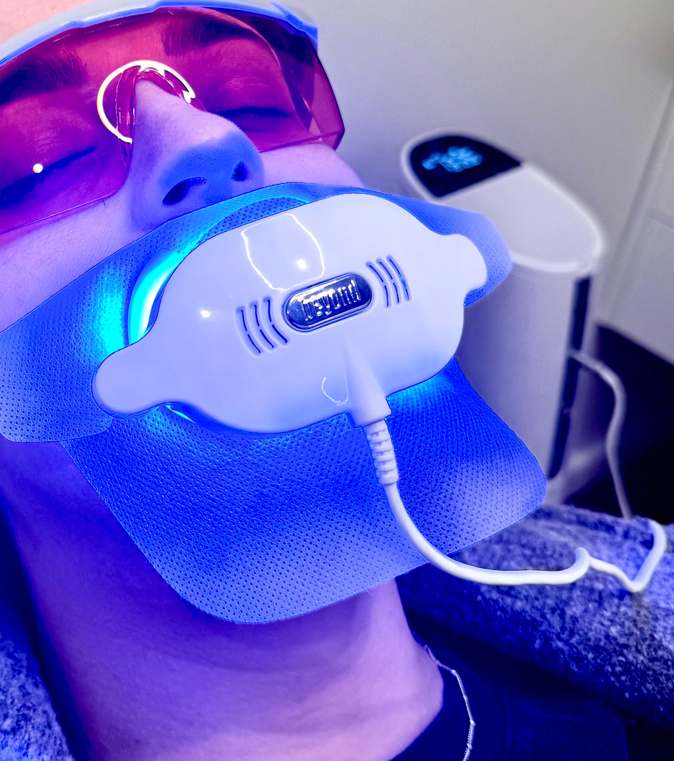 Blue light teeth whitening treatment