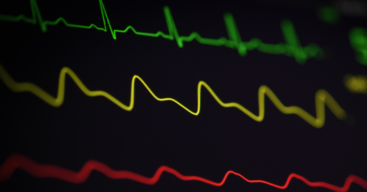 WHAT IS HEART RATE VARIABILITY AND WHY DOES IT MATTER?