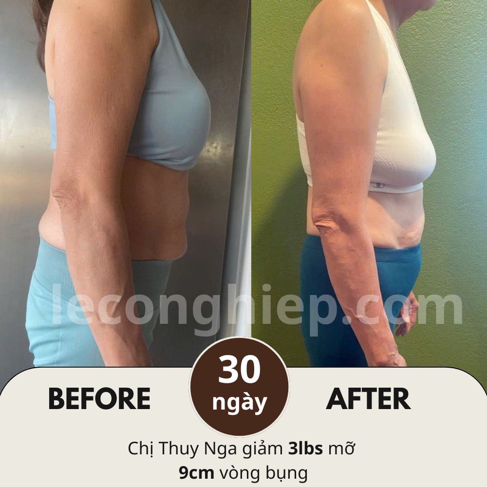 Case Study giảm 1,5kg mỡ và 9 cm vòng eo chị Nga trong 1 tháng - Giảm Mỡ Hạnh Phúc Case Study giảm 1,5kg mỡ và 9 cm vòng eo chị Nga trong 1 tháng - Giảm Mỡ Hạnh Phúc