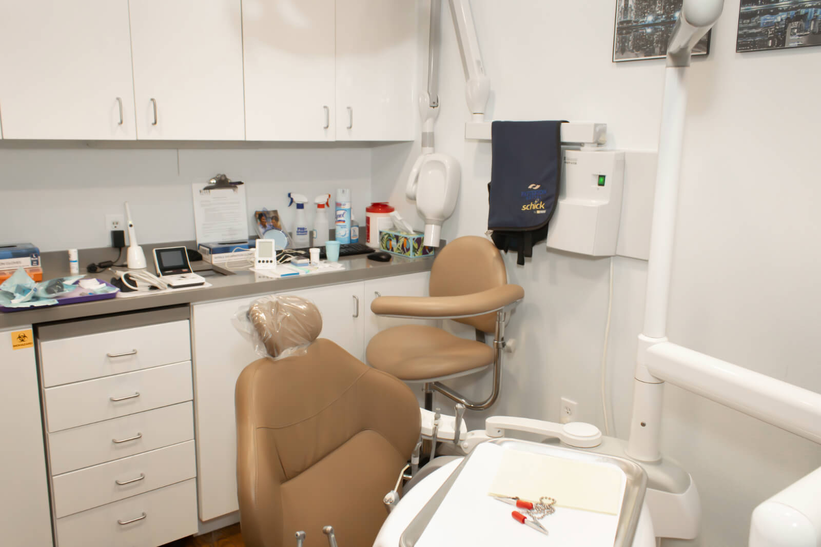 root canal
