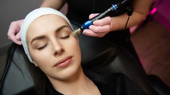 Microneedling Microneedling