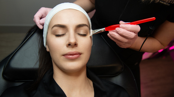 Chemical Peel Chemical Peel