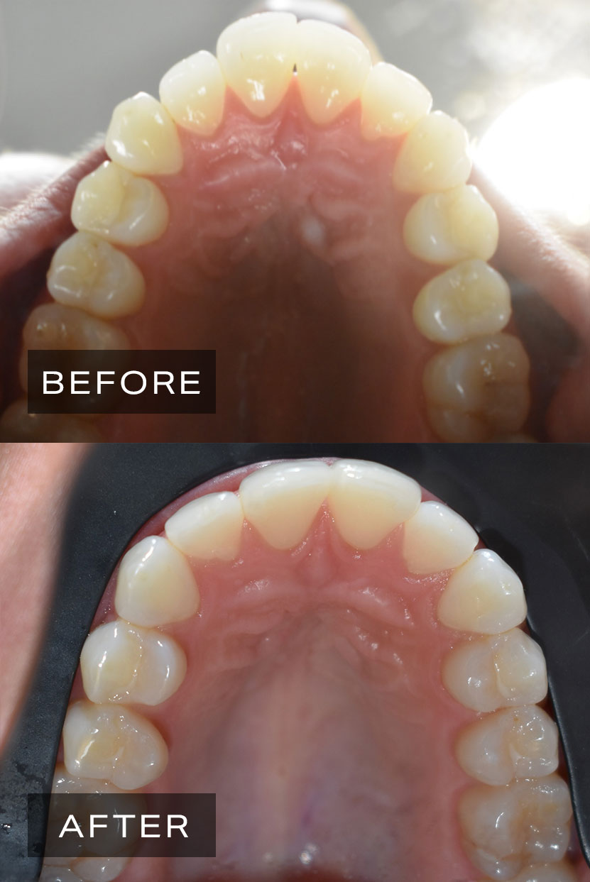 Dental Before After 5