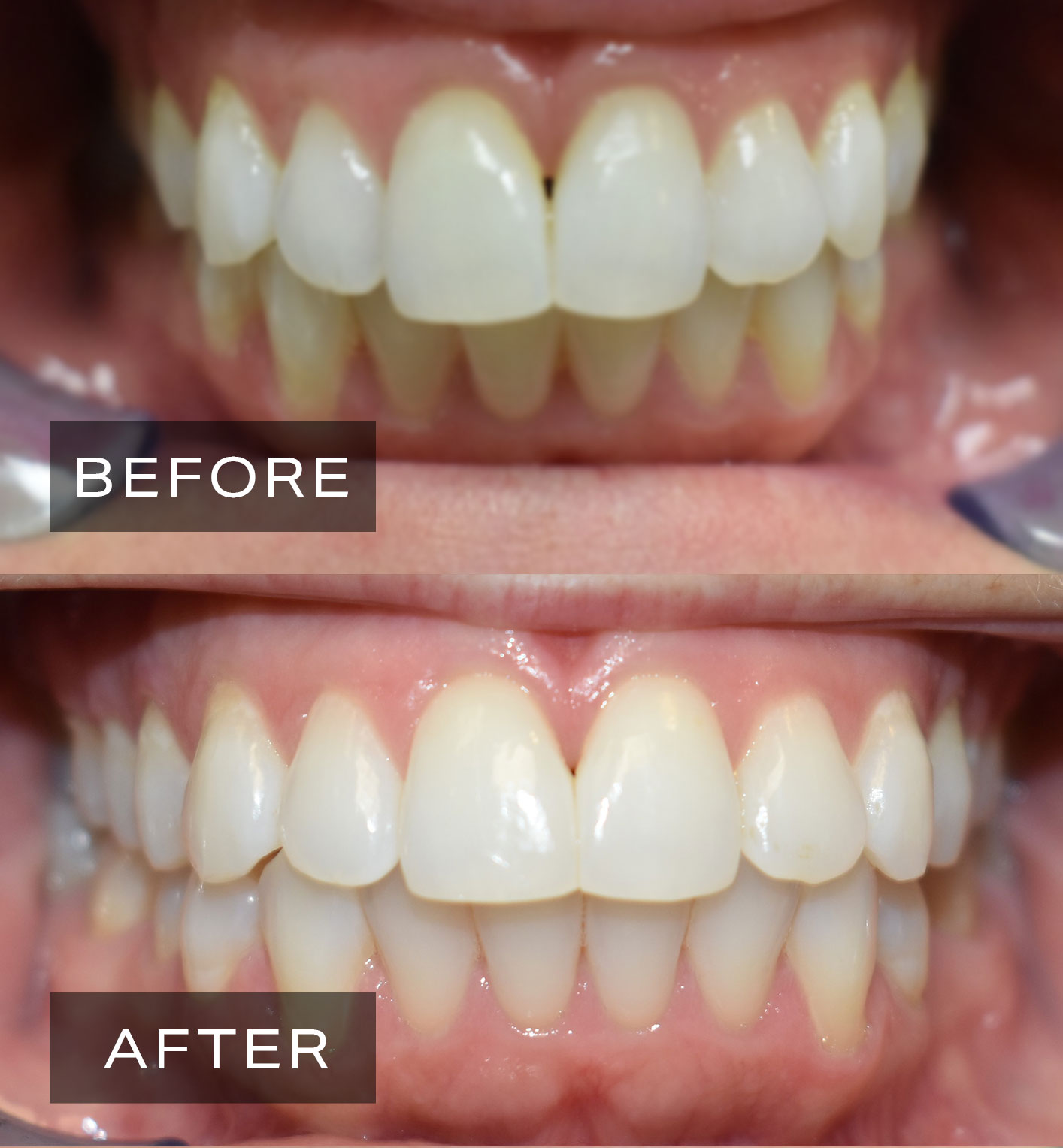 Dental Before After 1
