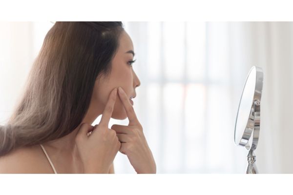  Why Skincare Alone Isn’t Fixing Your Teen’s Acne 🚫🧴"
