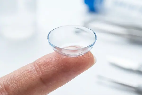 Large scleral contact lens on fingertip showing size and rigid gas permeable material for keratoconus treatment Large scleral contact lens on fingertip showing size and rigid gas permeable material for keratoconus treatment