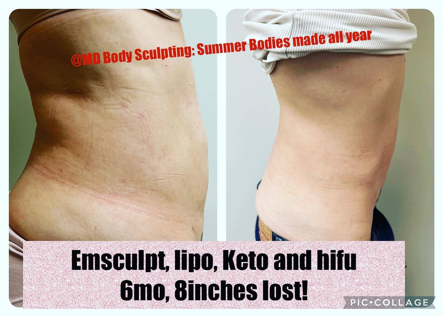 THE BEST 10 Body Contouring in COLUMBIA, MD - Updated March 2024 - Yelp