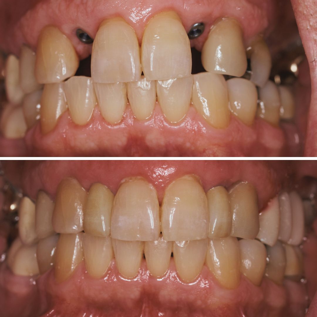 Dental Before After 5