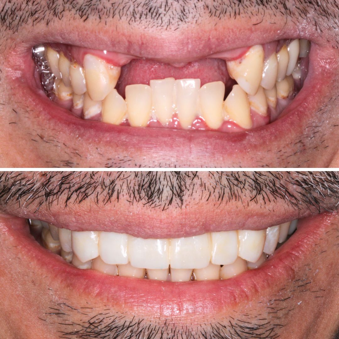 Dental Before After 1