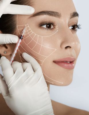 Close-up of a woman receiving a thread lift procedure with marked facial vectors, highlighting non-surgical facelift treatment and recovery process. Close-up of a woman receiving a thread lift procedure with marked facial vectors, highlighting non-surgical facelift treatment and recovery process.
