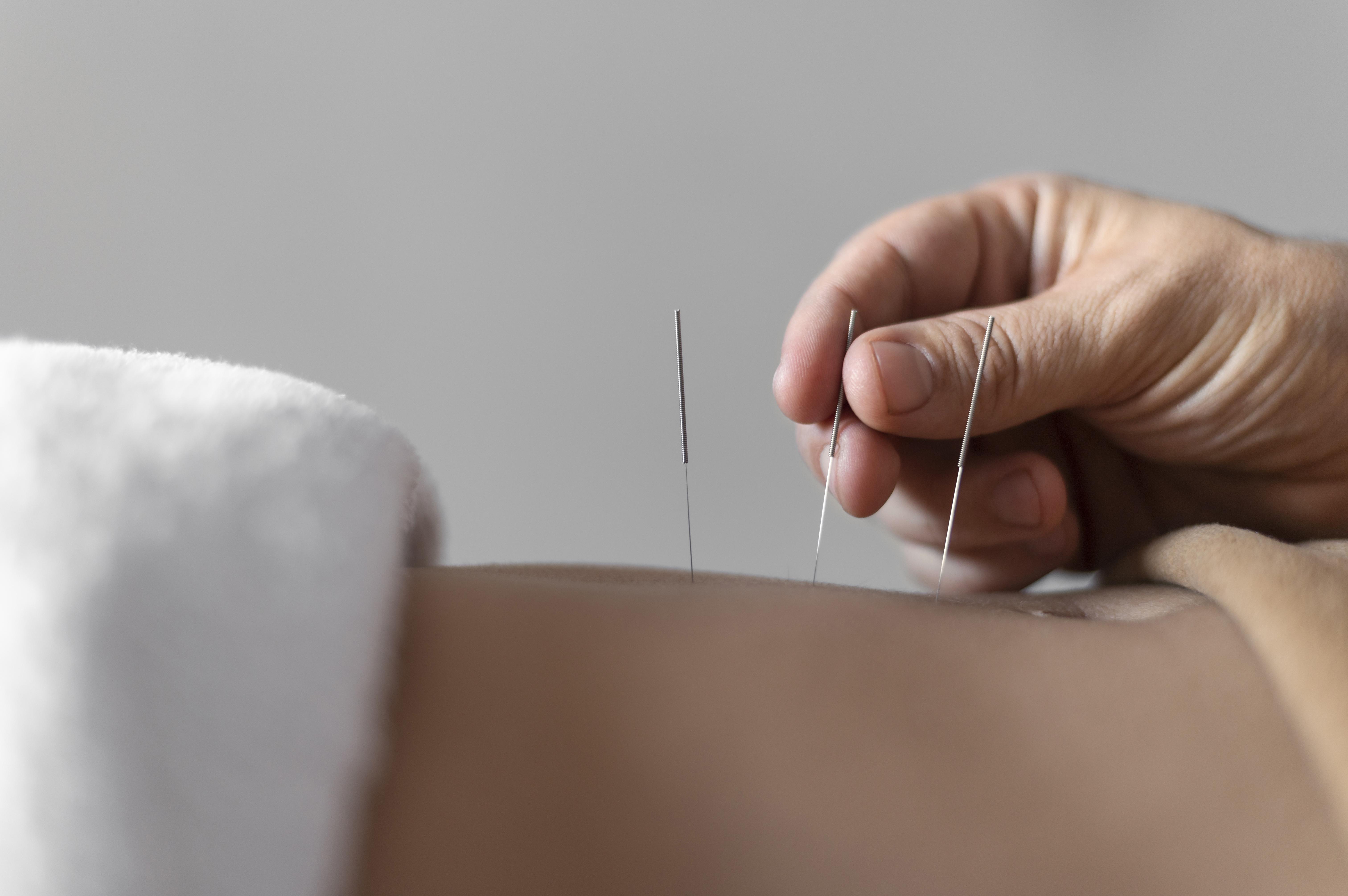 On Point Acupuncture Wellness