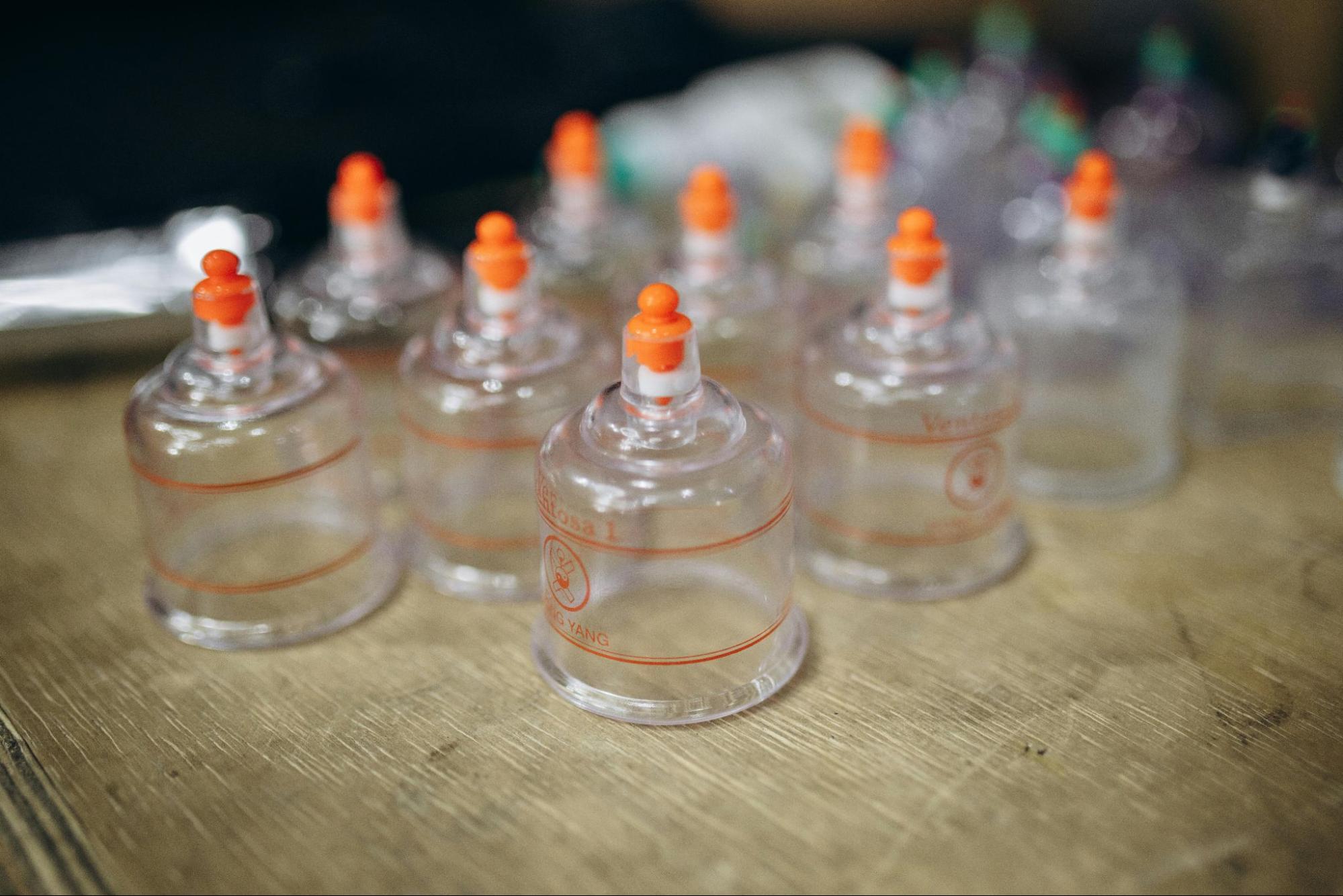 Cupping Treatment Cupping Treatment