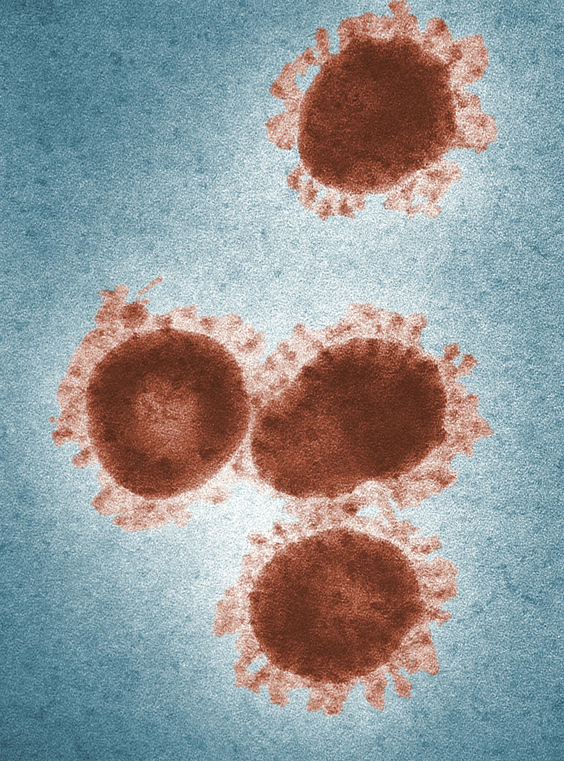 Microscopic view of harmful microorganisms, representing recurring sinus, ear, or chest infections caused by mould exposure.
