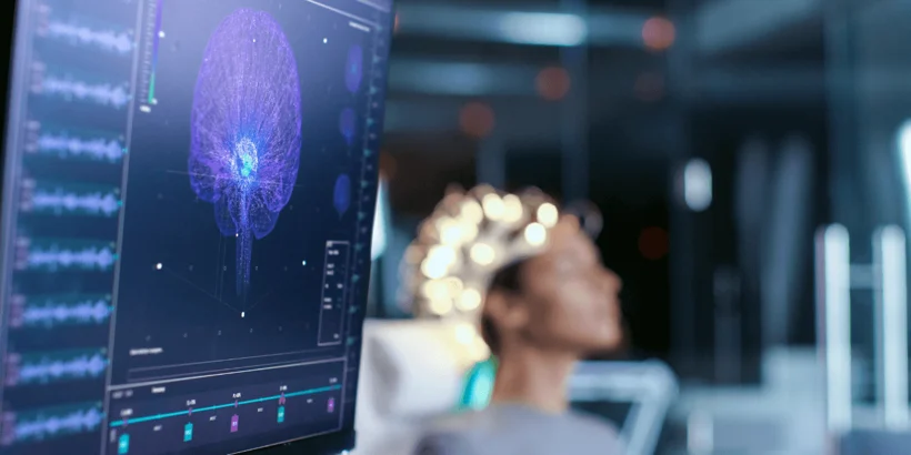 A brain scan showing the areas of the brain affected by post traumatic stress disorder A brain scan showing the areas of the brain affected by post traumatic stress disorder