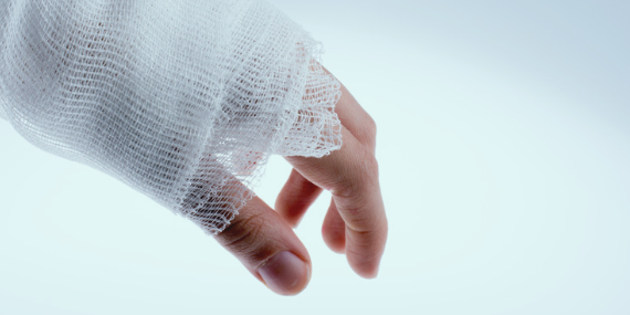 A close-up of a hand wrapped in white gauze bandage, with fingers slightly curled. The bandage appears slightly frayed at the edges, indicating an injury or healing process A close-up of a hand wrapped in white gauze bandage, with fingers slightly curled. The bandage appears slightly frayed at the edges, indicating an injury or healing process