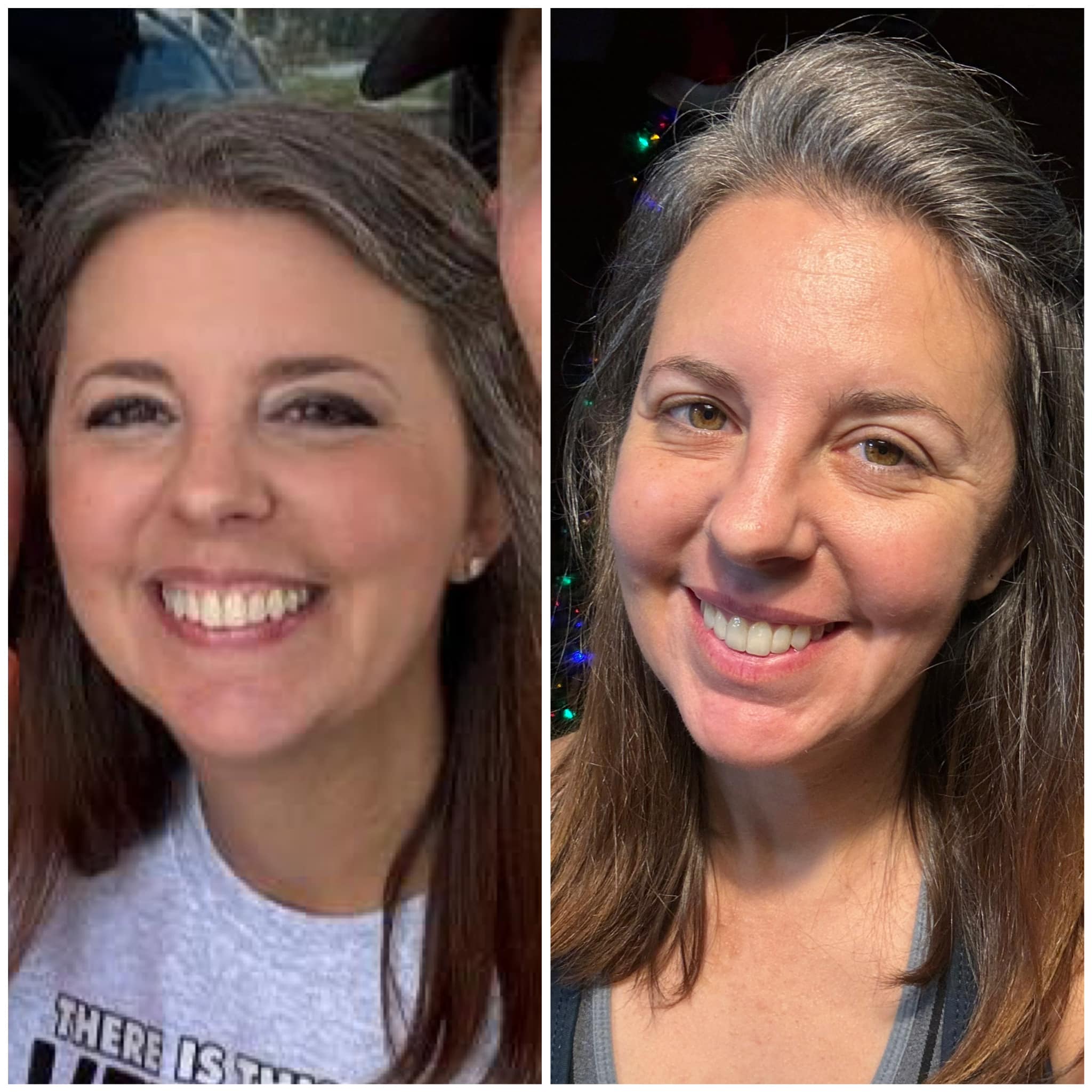Client result